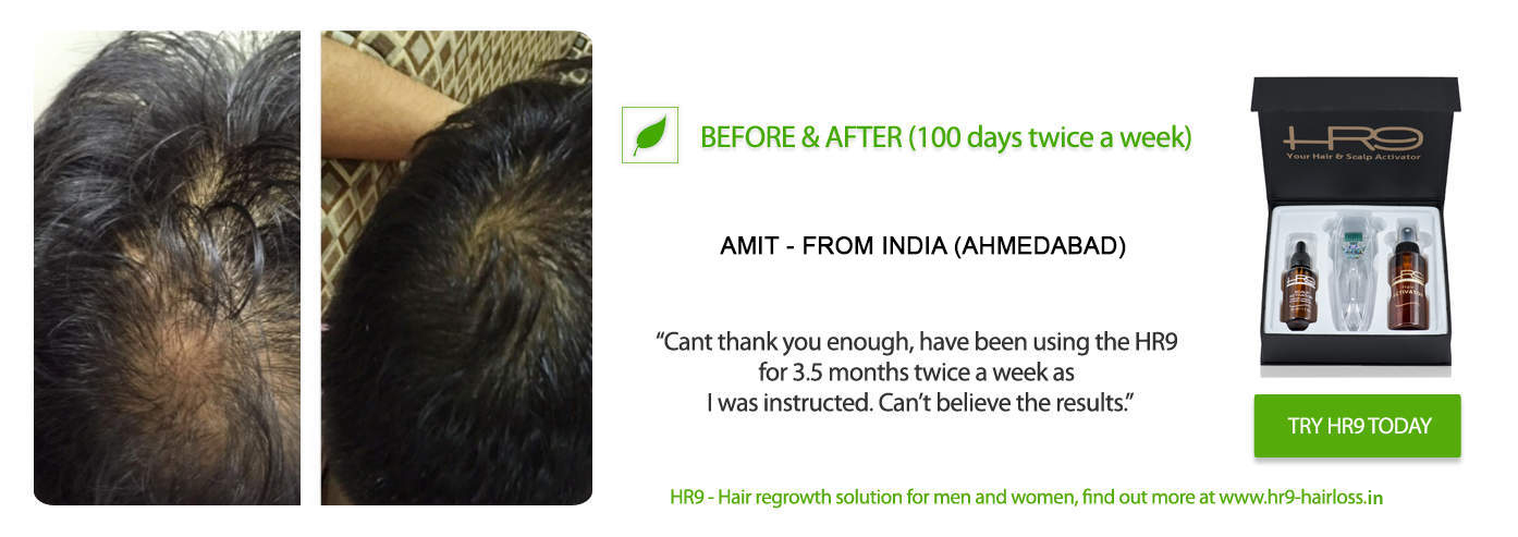 Hair Loss Success Stories
